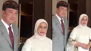 Kondisi Kesehatan Jokowi